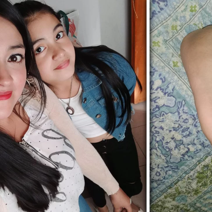 Aimara será operada en Buenos Aires para tratar la trombosis en su pie Aimara será operada en Buenos Aires para tratar la trombosis en su pie