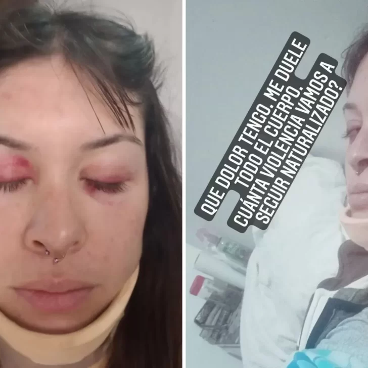 Una joven denunció que un grupo de patovicas la golpeó brutalmente en un club nocturno Una joven denunció que un grupo de patovicas la golpeó brutalmente en un club nocturno