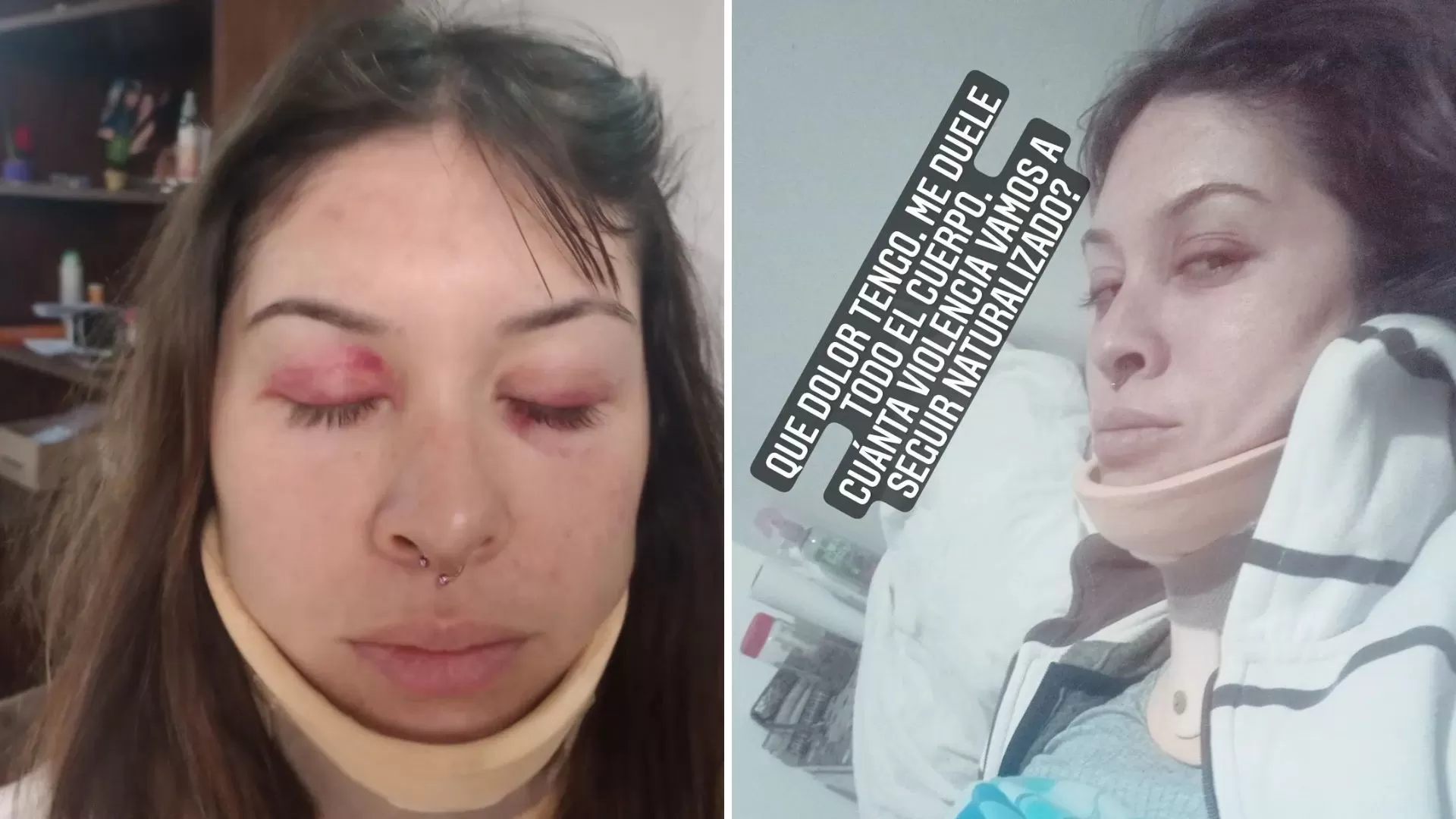 Una joven denunció que un grupo de patovicas la golpeó brutalmente en un club nocturno Una joven denunció que un grupo de patovicas la golpeó brutalmente en un club nocturno