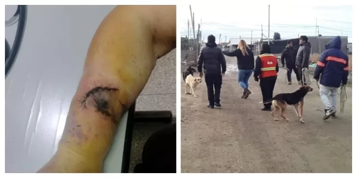 Perros: vecina con infección y fisura por la mordedura de Bóxer y municipales debieron ser escoltados por Control Animal