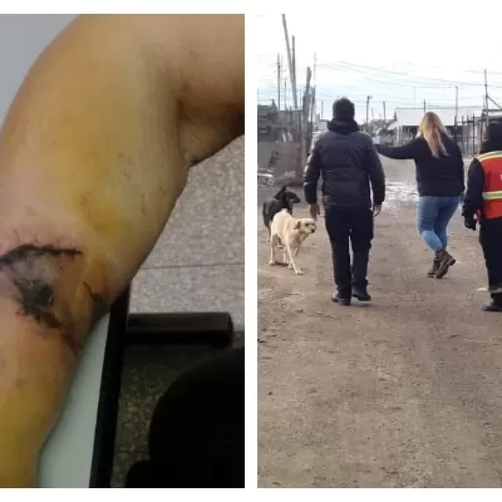 Perros: vecina con infección y fisura por la mordedura de Bóxer y municipales debieron ser escoltados por Control Animal