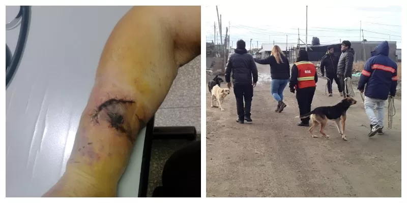 Perros: vecina con infección y fisura por la mordedura de Bóxer y municipales debieron ser escoltados por Control Animal