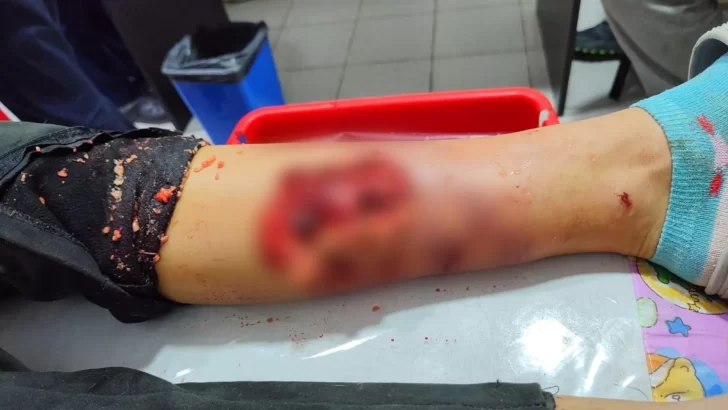 “El perro la arrastró por el piso”: contó la mamá de la nena atacada por un pitbull en Río Gallegos