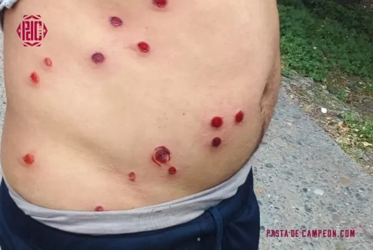 Balas de goma e incidentes en la previa entre Jorge Newbery y Liniers