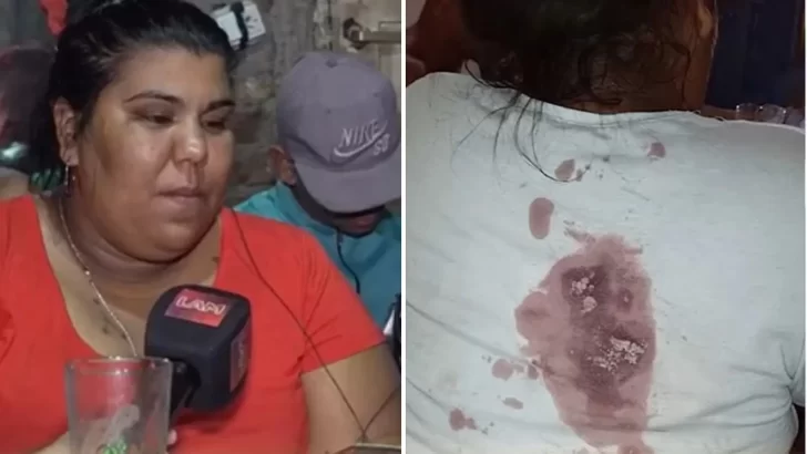 Así fue el ataque a cuchillazos a Camila, la hermana de Thiago de Gran Hermano