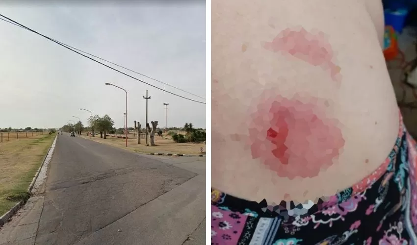 Insólito: un caballo suelto siguió a una chica y la mordió Insólito: un caballo suelto siguió a una chica y la mordió