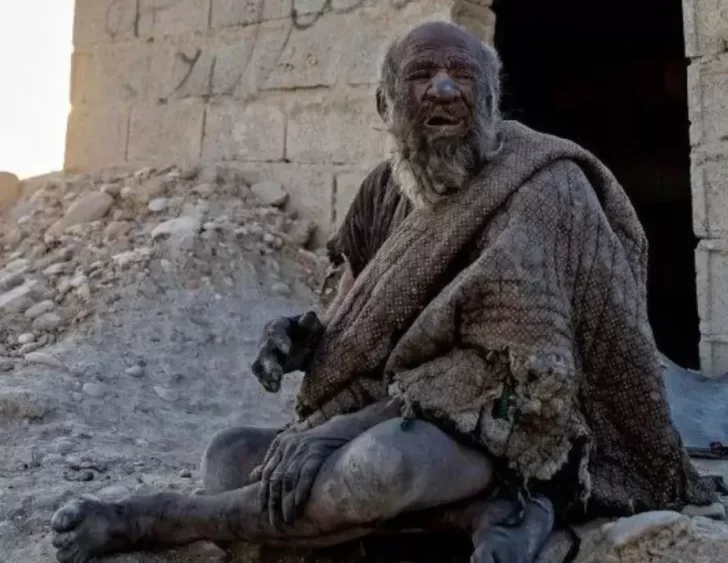 Triste récord: a los 94 años, murió el hombre más sucio del mundo