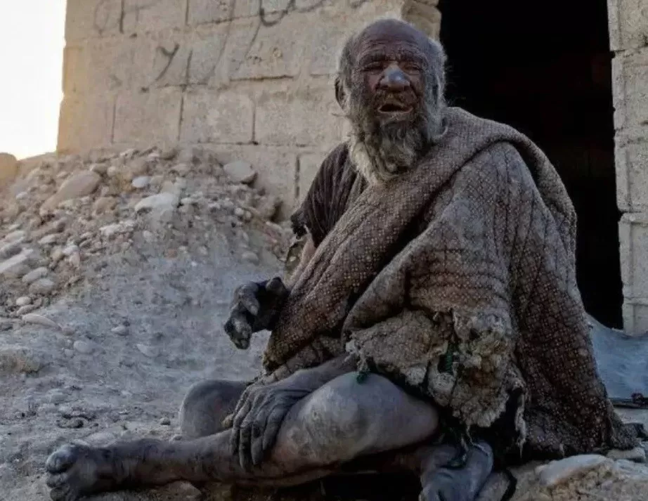 Triste récord: a los 94 años, murió el hombre más sucio del mundo