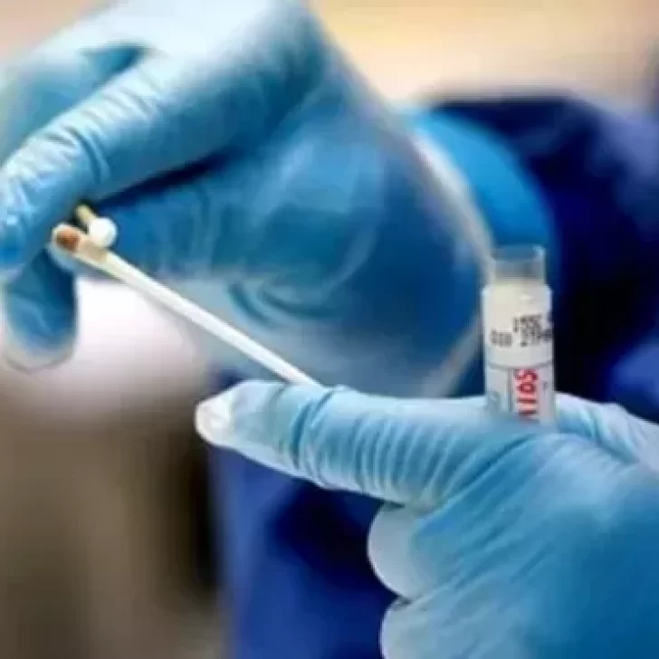 ¿Test de antígenos, PCR o serológicos? Cuál es la diferencia entre las pruebas de COVID-19 ¿Test de antígenos, PCR o serológicos? Cuál es la diferencia entre las pruebas de COVID-19