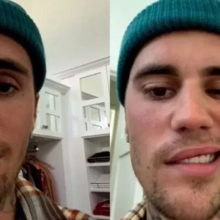 ¿Qué es el síndrome de Ramsay Hunt?: la enfermedad que le diagnosticaron a Justin Bieber
