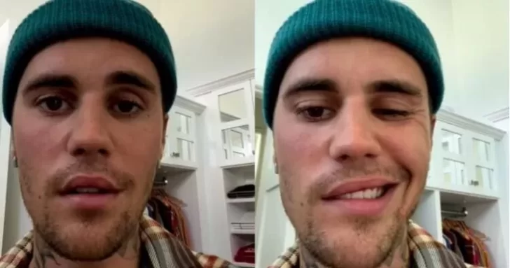 Justin Bieber reveló que sufre extraño síndrome que paralizó la mitad de su rostro