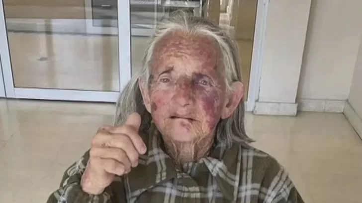 Una anciana fue brutalmente golpeada durante un robo: “No me merezco esta crueldad”