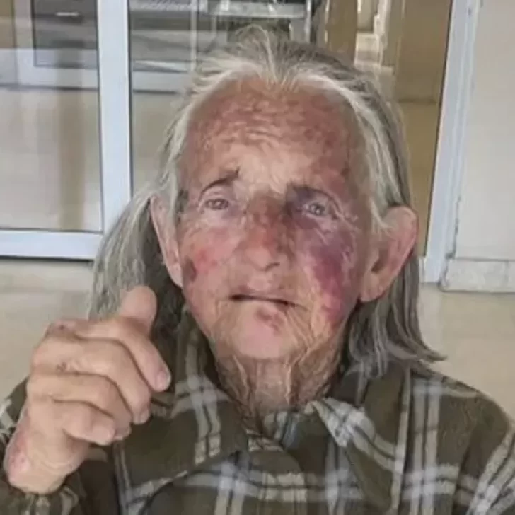 Una anciana fue brutalmente golpeada durante un robo: “No me merezco esta crueldad”