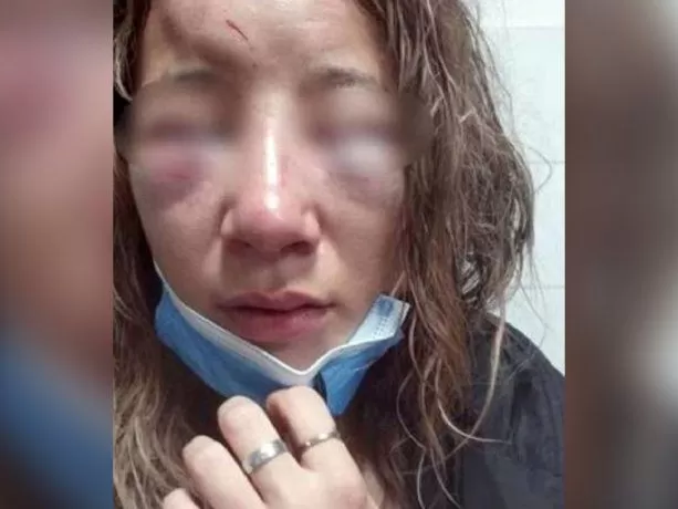 Una joven fue golpeada a la salida de un boliche y la arrastraron hasta arrancarle las uñas