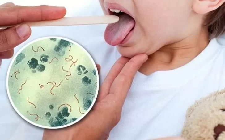 Qué es Streptococcus pyogenes, la bacteria que provocó 16 muertes en Argentina