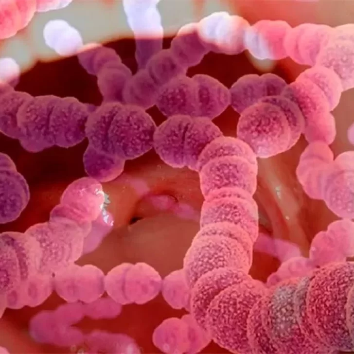 Faringitis aguda: tres muertes en Tierra del Fuego por infecciones con “streptococcus pyogenes” Faringitis aguda: tres muertes en Tierra del Fuego por infecciones con “streptococcus pyogenes”