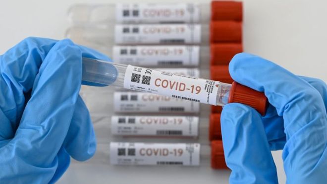 4.231 nuevos casos de Covid-19 en Argentina