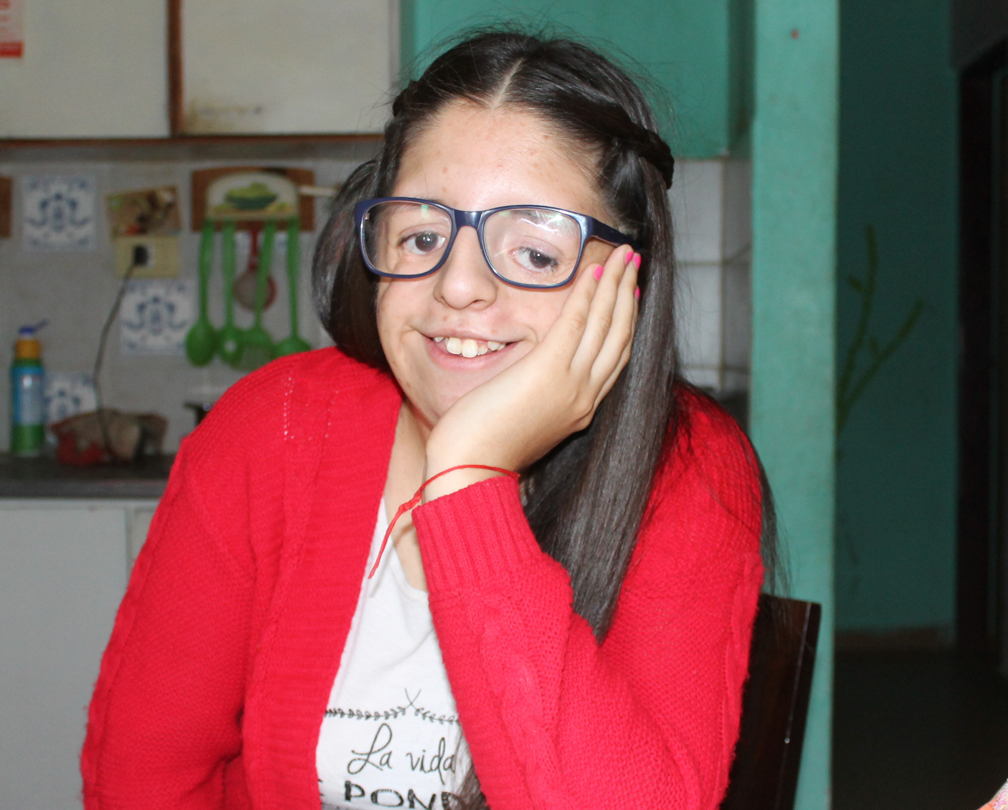 Es de Caleta, nació con el extraño síndrome de Treacher Collins y hoy ayuda a chicos con enfermedades poco frecuentes Es de Caleta, nació con el extraño síndrome de Treacher Collins y hoy ayuda a chicos con enfermedades poco frecuentes