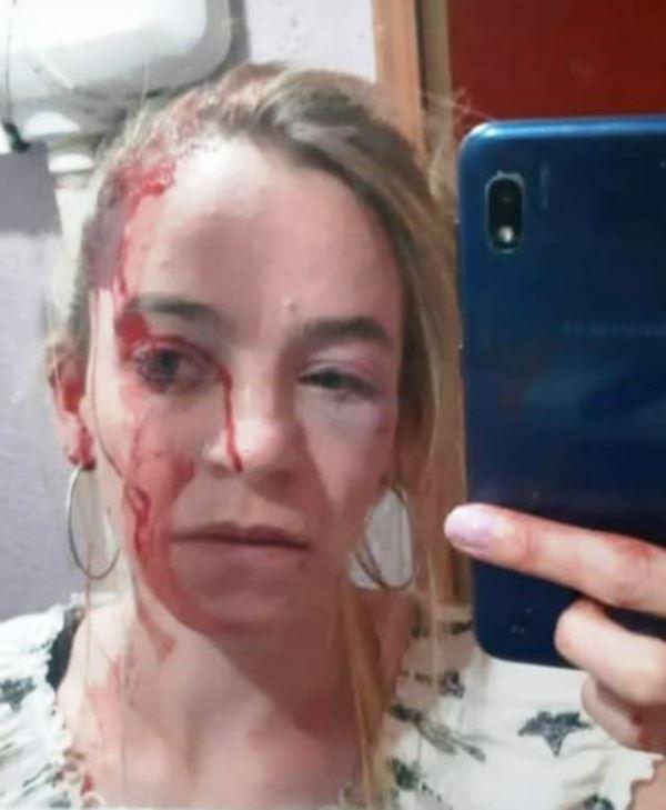 Una mujer de El Calafate fue salvajemente golpeada por su ex pareja