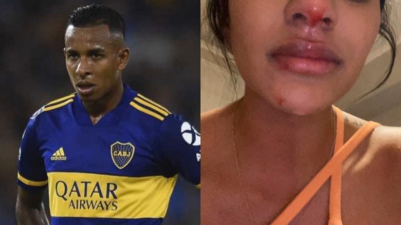 El duro relato de la ex novia de Sebastián Villa: “Perdí un embarazo por sus golpes” El duro relato de la ex novia de Sebastián Villa: “Perdí un embarazo por sus golpes”