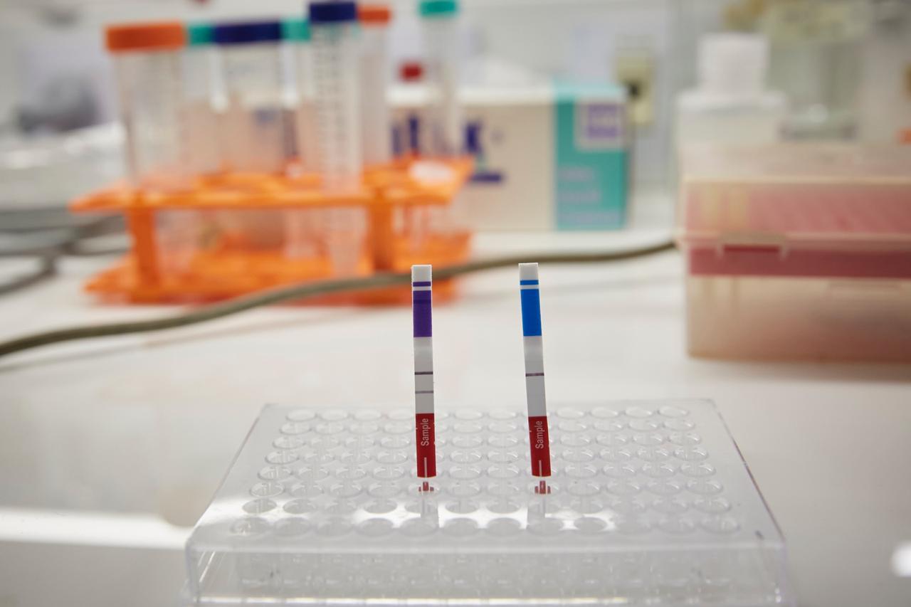 19 muertos y 1.581 nuevos contagios de coronavirus en Argentina 19 muertos y 1.581 nuevos contagios de coronavirus en Argentina