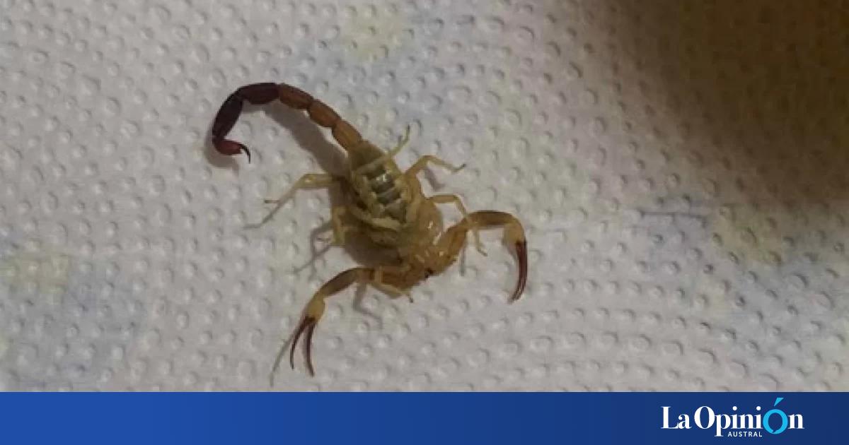 Para Saber C Mo Evitar Los Alacranes Y Qu Hacer En Caso De Encontrar Uno En Casa La