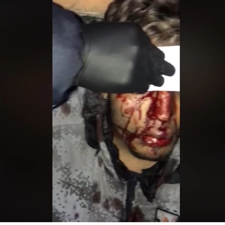 Golpearon salvajemente en la calle al hermano del barbero colombiano denunciado de acosar a una menor de edad