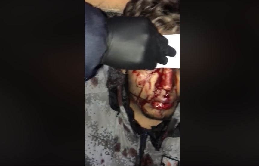 Golpearon salvajemente en la calle al hermano del barbero colombiano denunciado de acosar a una menor de edad