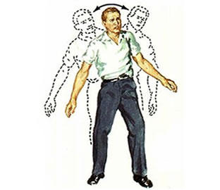 ataxia