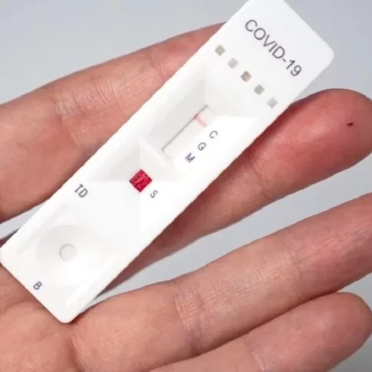 Los autotest para detectar el COVID-19 podrían estar en las farmacias para enero