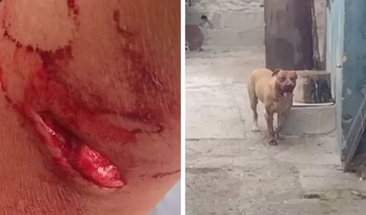 Un pitbull se escapó cuando sus dueños no estaban y atacó a una mujer