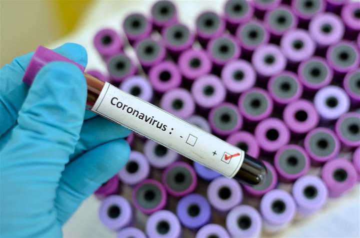 Nuevo récord: 38 muertos y 2.635 nuevos contagios de coronavirus en Argentina