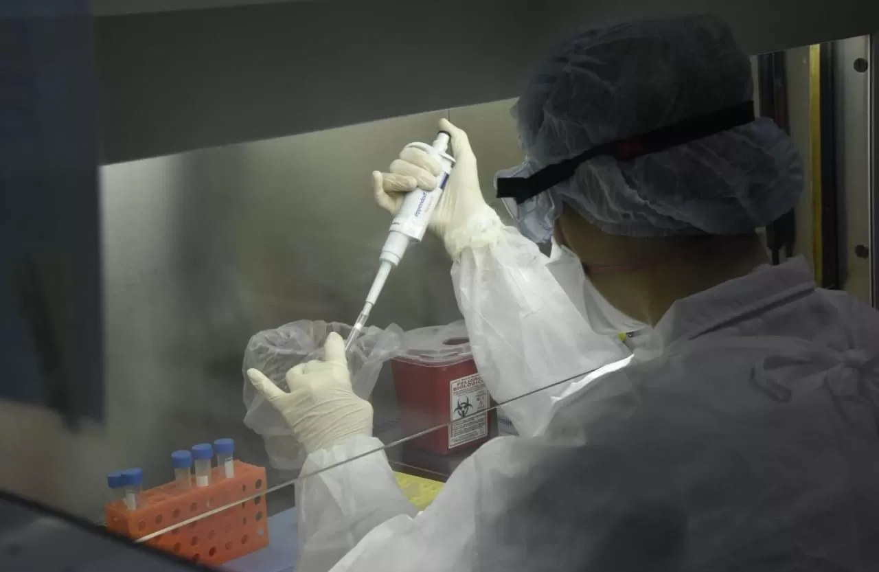 Ministerio de Salud informó sobre un caso notificado de hongo negro asociado al Covid-19