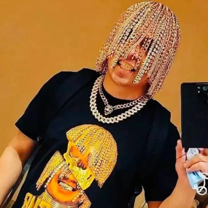 El cantante de rap Dan Sur se implantó cadenas de oro en su cabeza: “Espero que no todos me copien a mí ahora” El cantante de rap Dan Sur se implantó cadenas de oro en su cabeza: “Espero que no todos me copien a mí ahora”