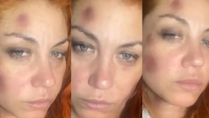 “El amor no duele”: Lourdes de Bandana denunció a su ex novio por violencia