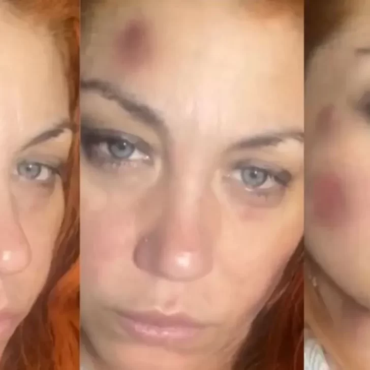 “El amor no duele”: Lourdes de Bandana denunció a su ex novio por violencia