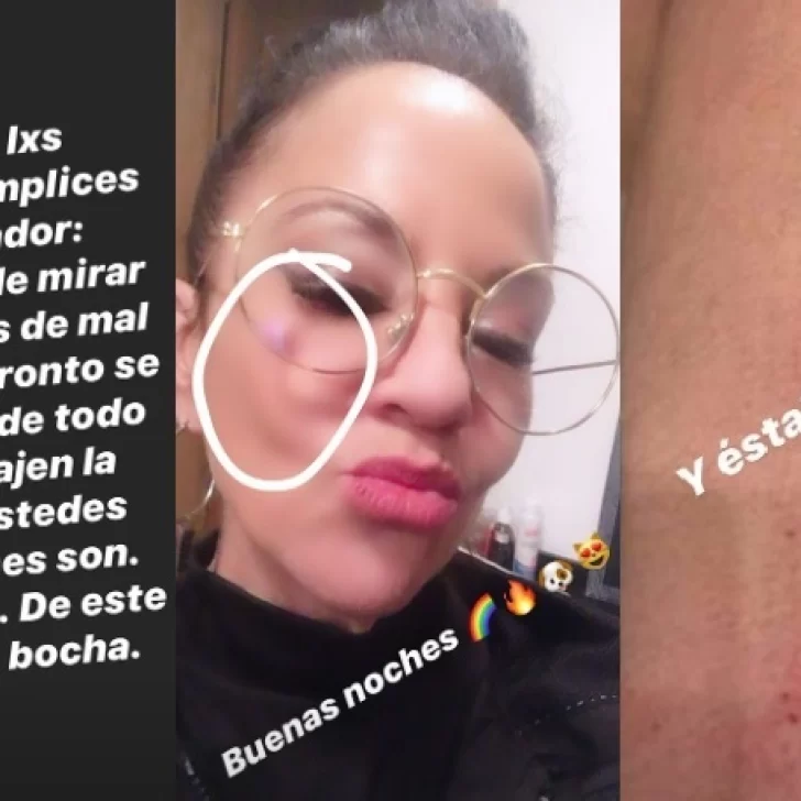 ¿Qué pasó con Miss Bolivia? Su separación, denuncia en redes y fotos de golpes