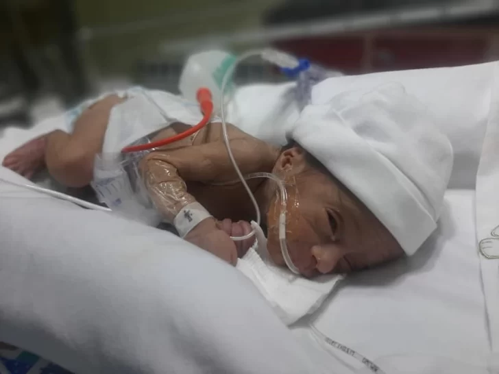 Río Gallegos: un bebé de 30 semanas de gestación fue operado dos veces en el servicio de neonatología