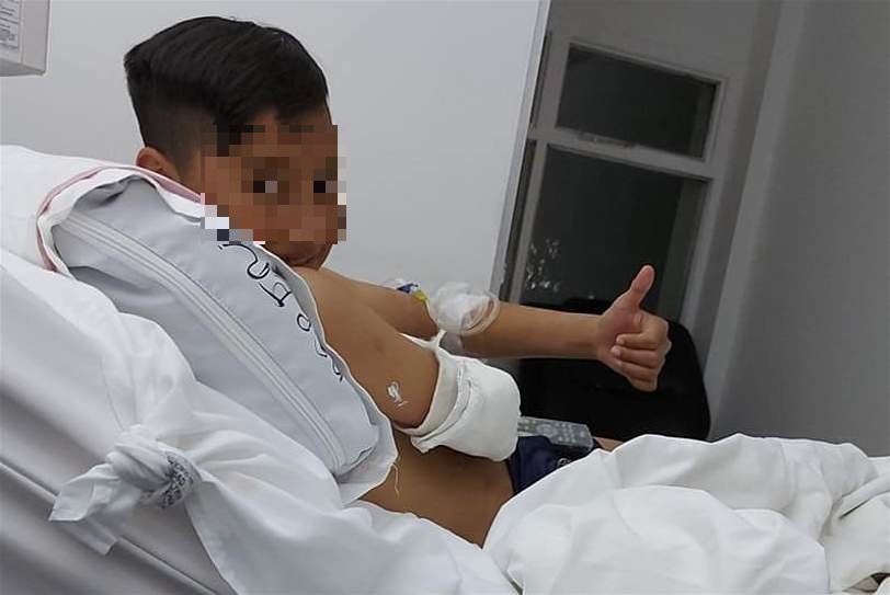 Niño se quebró la muñeca al caer en una vereda rota alrededor de la Laguna María La Gorda