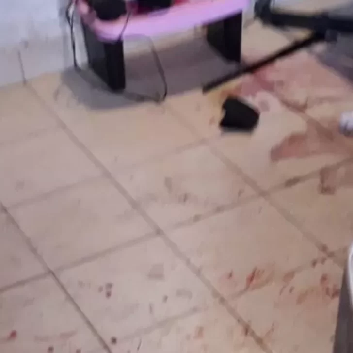 Un joven y un chico de 13 años entraron a una casa y atacaron al dueño a palazos Un joven y un chico de 13 años entraron a una casa y atacaron al dueño a palazos