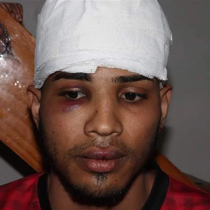 “Es xenofobia” y “complot”, dijo Elías García, peluquero denunciado por acoso sexual, tras la brutal golpiza a su hermano “Es xenofobia” y “complot”, dijo Elías García, peluquero denunciado por acoso sexual, tras la brutal golpiza a su hermano