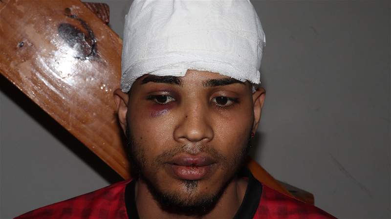 “Es xenofobia” y “complot”, dijo Elías García, peluquero denunciado por acoso sexual, tras la brutal golpiza a su hermano “Es xenofobia” y “complot”, dijo Elías García, peluquero denunciado por acoso sexual, tras la brutal golpiza a su hermano