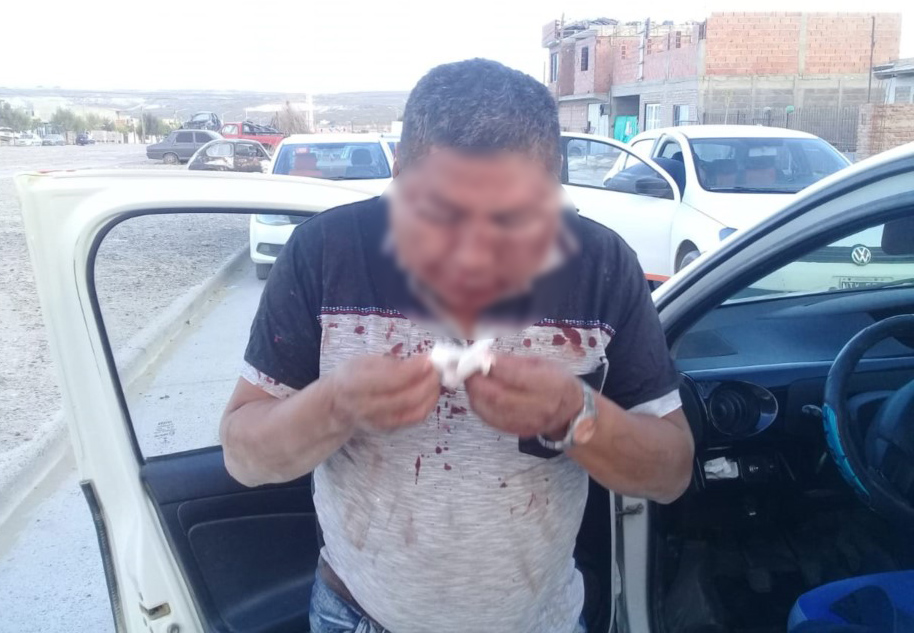 Una pareja creyó que un taxista había querido secuestrar a su hijo y lo desfiguraron a golpes