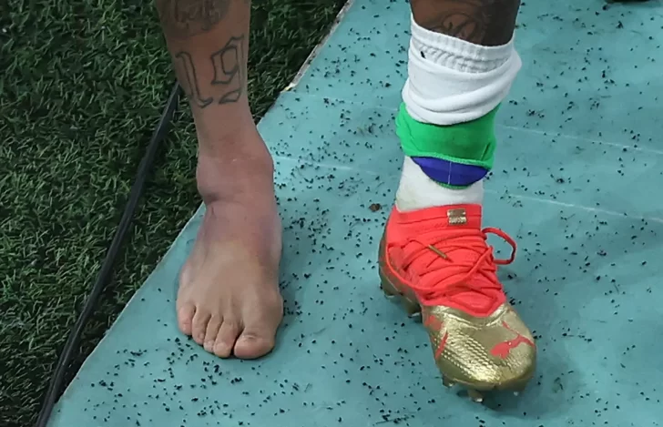 Qué es la entorsis de tobillo, la lesión que sufrió Neymar en el debut de Brasil en Qatar 2022
