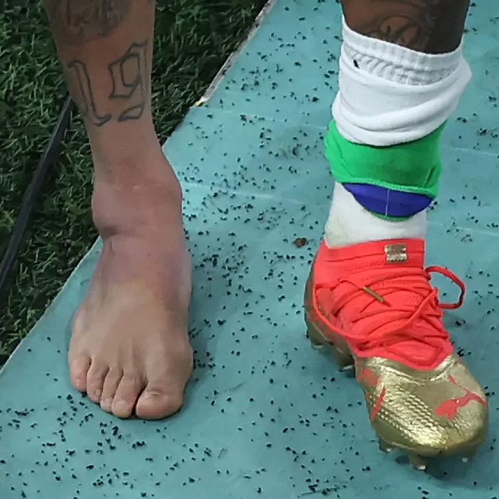 Qué es la entorsis de tobillo, la lesión que sufrió Neymar en el debut de Brasil en Qatar 2022