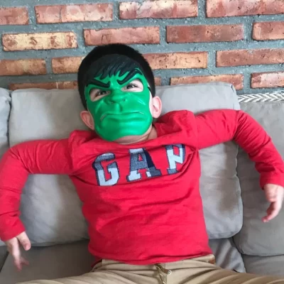 “Un verdadero Hulk”: la historia de Tomás, el único caso de Síndrome PTEN conocido en Santa Cruz y en Argentina