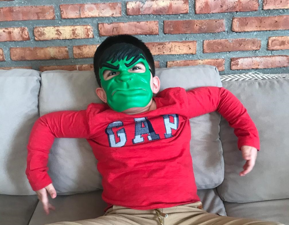 “Un verdadero Hulk”: la historia de Tomás, el único caso de Síndrome PTEN conocido en Santa Cruz y en Argentina