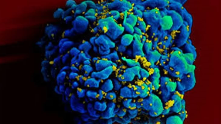 Detectaron un virus similar al ébola en Bolivia que se transmite entre humanos