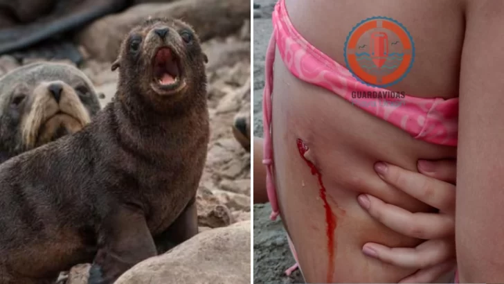 Una nena santacruceña fue mordida por un lobo marino en Playa Unión 