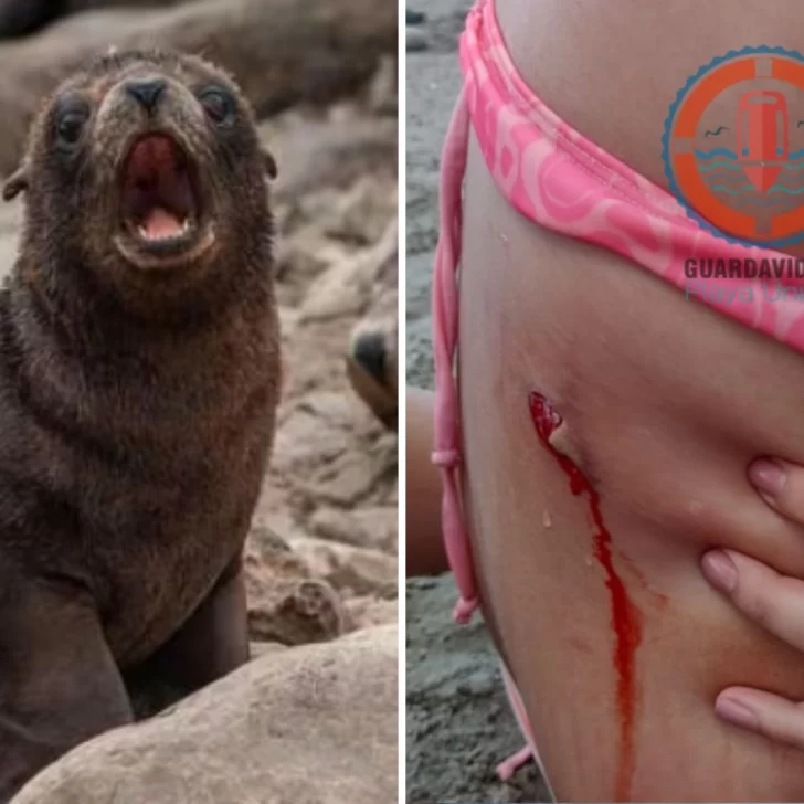 Una nena santacruceña fue mordida por un lobo marino en Playa Unión 
